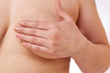 40 yaşında şişman bir kadın sarkık göğüslerini beyaz bir arka planla kapatıyor. Tıp ve kozmetoloji kavramı