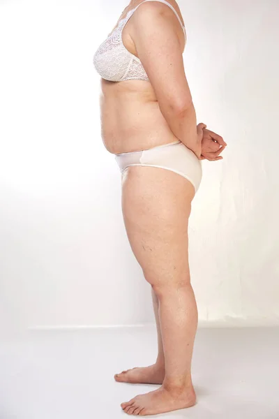 A 40-year-old Woman In Underwear With Sagging Breasts, Overweight, Stretch  Marks And Cellulite On A White Isolated Background. Concept For Medicine  And Cosmetology Stock Photo, Picture and Royalty Free Image. Image  146104197.