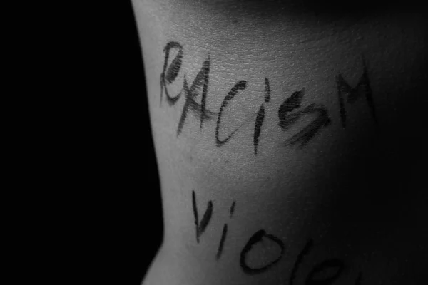 Parte Del Corpo Una Giovane Ragazza Con Parole Razzismo Iscrizioni — Foto Stock