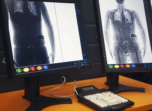 Vücut tarayıcı. Havaalanı