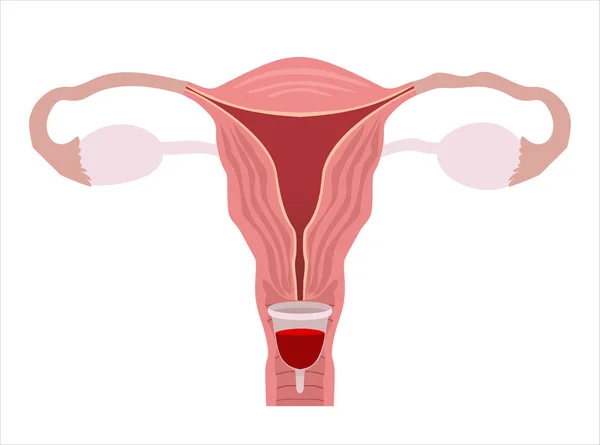 Menstruációs Csésze Női Higiéniai Termék Eszköz Összegyűjtésére Vért Menstruáció Alatt — Stock Vector