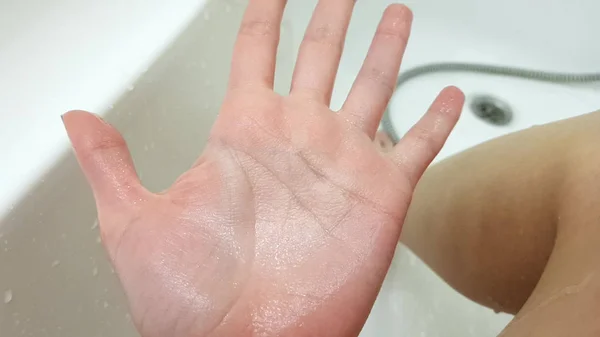 Rynkig kvinnlig hand på grund av blötläggning i vattnet under en lång tid, våt vitt badrum och ben på bakgrunden. — Stockfoto
