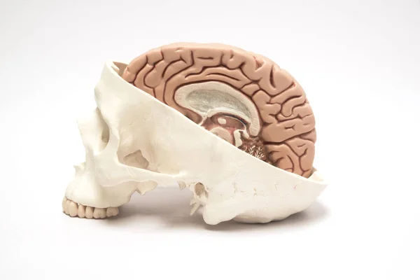 Modelos artificiales de cerebro y cráneo humano — Foto de Stock