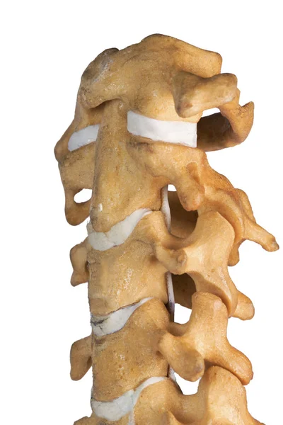 Sztuczne ludzkiego kręgosłupa szyjnego — Zdjęcie stockowe