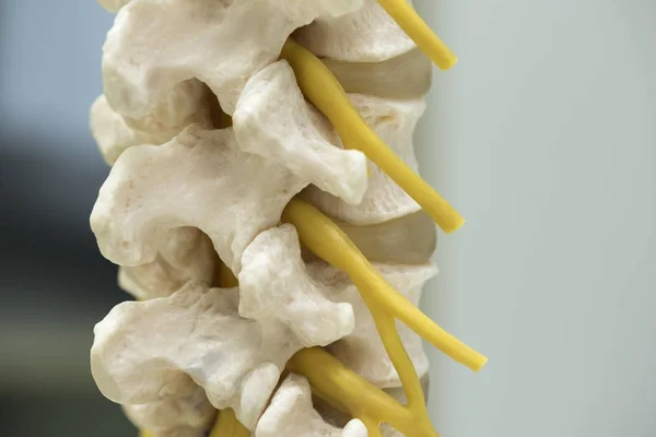 Lendenwirbelsäule mit austretendem Nervenwurzelmodell — Stockfoto