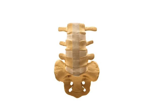 Modello di colonna vertebrale lombare isolato su sfondo bianco — Foto Stock