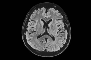 İnsan beyni MRI, Aksiyel görünüm