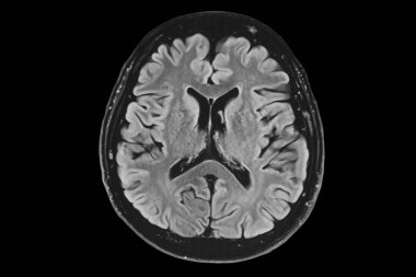 Human brain MRI, axial view clipart