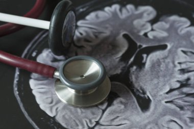 Tıbbi ekipmanlar ve MRG resmi