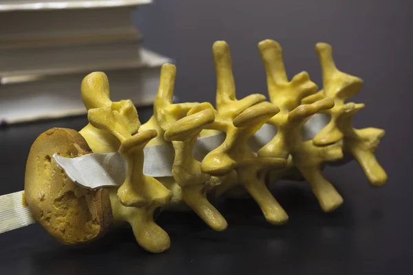 Modello di colonna vertebrale lombare sul tavolo — Foto Stock