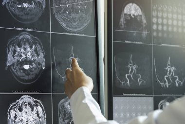 MRI beyin Radyoloji odasında işaret eden doktor