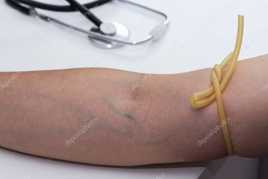 A tourniquet binding the arm form blood drawn
