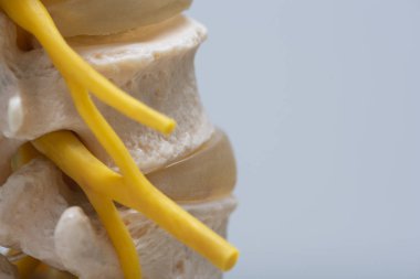 Omurga deliği omurga modelindeki çıkmadan sinir kökü