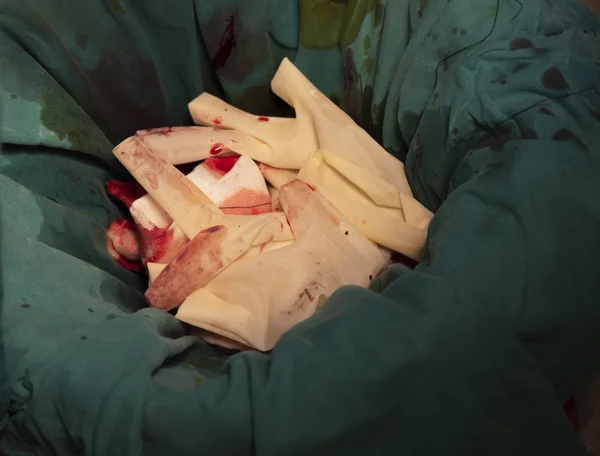 Cerrahi çöp kutusuna ameliyathane