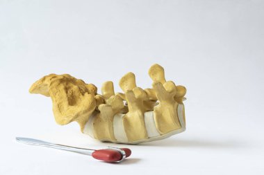 Lomber modeli ve refleks çekici