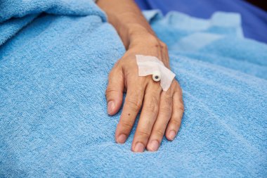 Heparin kilidi olan sol el hastasının yakın görüntüsü 