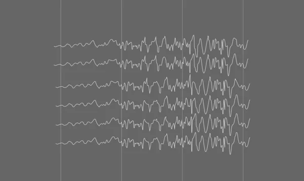 Epiléptica convulsión ondas cerebrales sobre fondo negro — Vector de stock