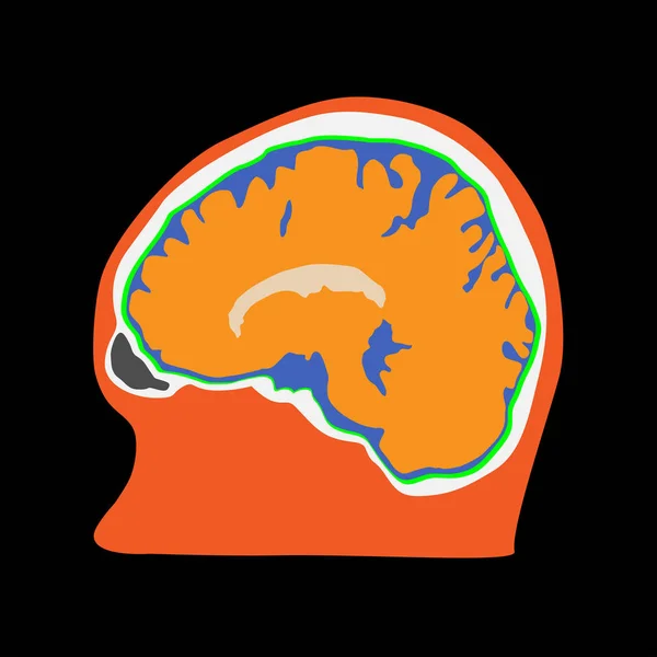 Sidovy av mänsklig hjärna illustration — Stock vektor