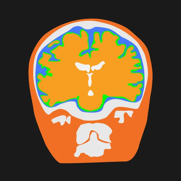 Human brain illustration on the black background. — 스톡 벡터