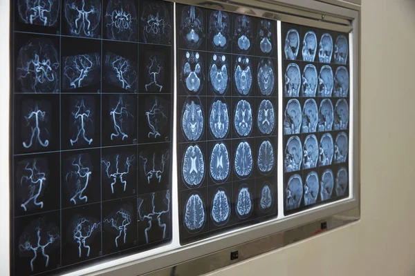 Brain magnetic resonance imaging on the lightbox