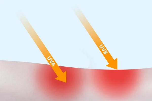 Brazo de mujer con penetración de UVA y UVB en la piel —  Fotos de Stock