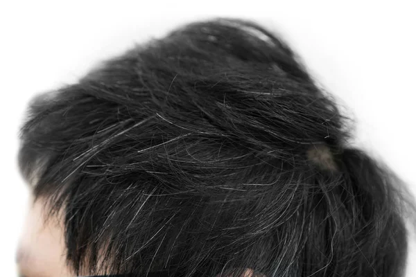 Young man with gray hair on his head — Stock Photo, Image