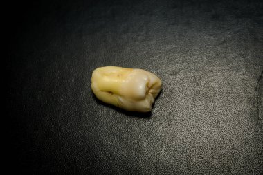 Diş çıkarma sonra