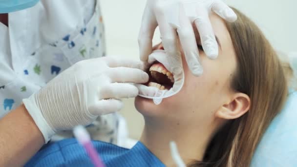 歯医者の白いラテックス手袋の男性歯科医は歯医者で患者の女の子にゴムダムを置きます — ストック動画