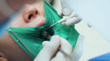 Diş aletleri kullanan bir doktor genç bir kızın dişini inceliyor. Diş, lateks yeşil plastik barajla izole edilmiş. Yakın plan..