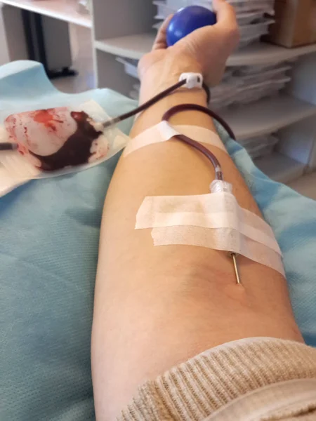 Hombre con la aguja al donar sangre en el hospital — Foto de Stock
