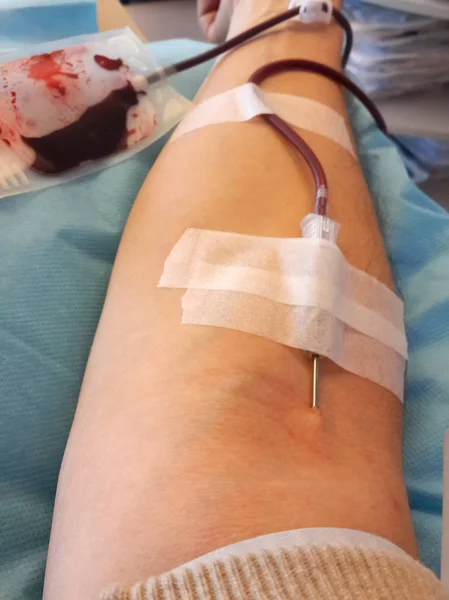 Joven con la aguja al donar sangre en el hospital — Foto de Stock