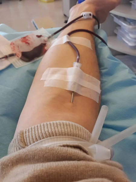 Adulte avec l'aiguille pendant la transfusion sanguine à l'hôpital — Photo