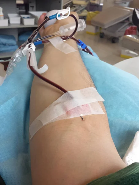 Brazo de un hombre en el hospital al donar sangre con la aguja — Foto de Stock