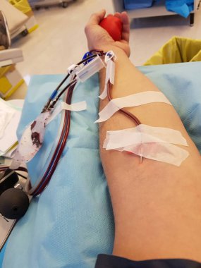 örnekleme ve hasta kol ile kan nakli sırasında kan