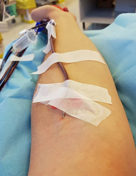 Bir kan verici cerrahi iğne ile kol — Stok fotoğraf