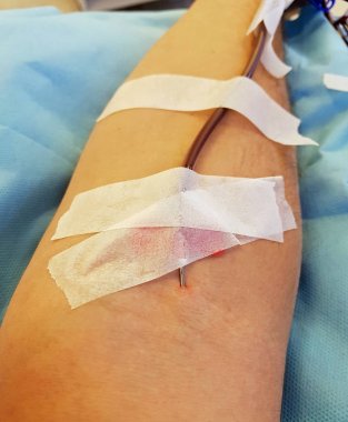 Kol cerrahi iğne ile cömert bir gönüllü kan verici 