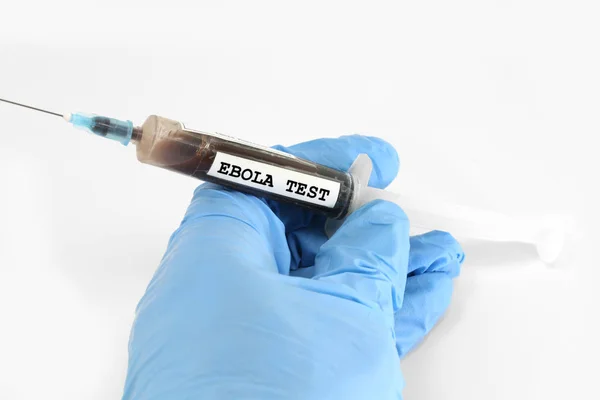 Syringe full of blood to be analyzed in the medical laboratory a — Stock Photo, Image