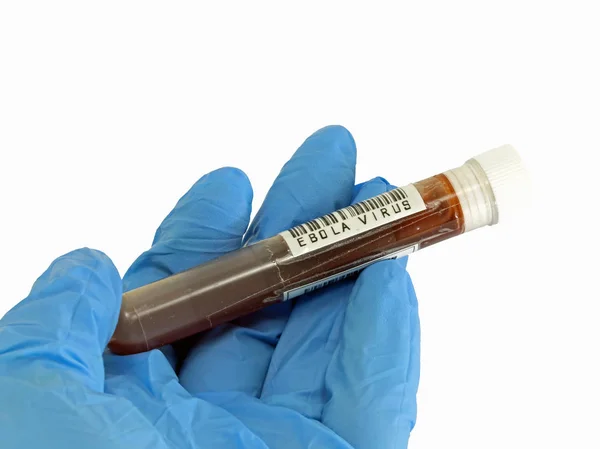 Tubo de ensayo con sangre infectada con el virus del ébola durante el laboratorio —  Fotos de Stock