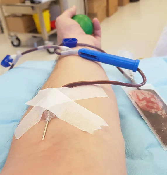 Doação de sangue real no hospital com a agulha inserida int — Fotografia de Stock