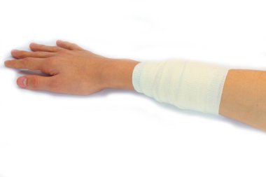 Kol üstüne kol yanığı.