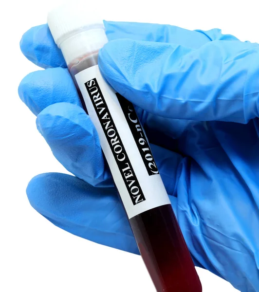 Éprouvette pour les tests sanguins de Coronavirus sur fond blanc — Photo