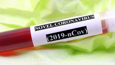 test tube for blood tests of the contagious virus during analyze