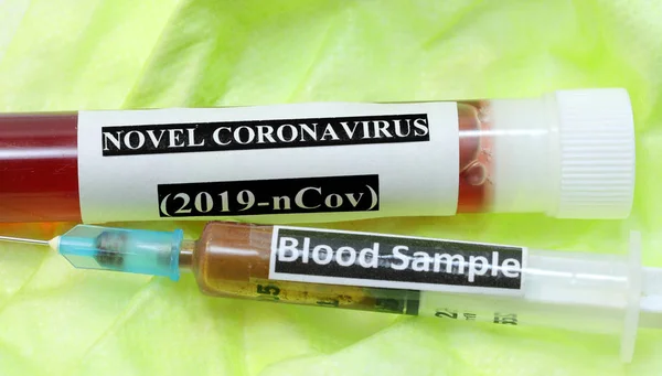 Трубка для анализа коронавируса и шприц — стоковое фото