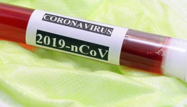 Ölümcül koronavirüsün kontrolü için kanla test tüpü.