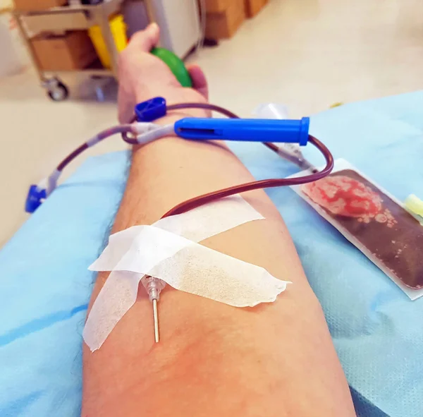 Brazo donante de sangre durante la plasmaféresis en un centro hospitalario — Foto de Stock