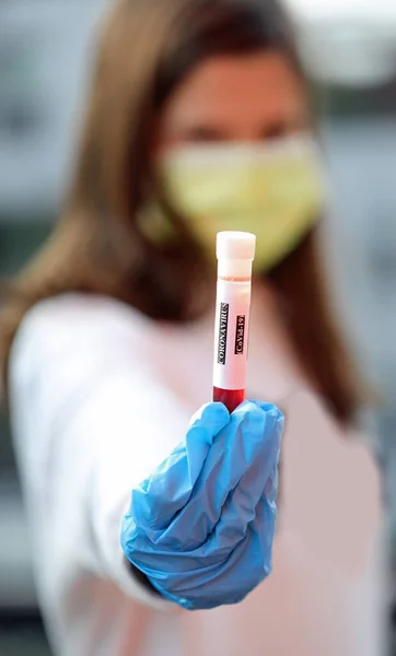 若い看護師の手は恐ろしいと伝染性コロナウイルスの分析のための血液サンプルと外科用マスクを身に着けている略語コヴィド — ストック写真