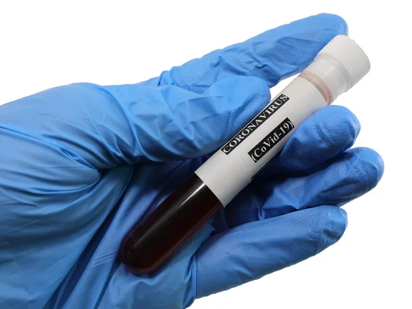 致命的なコロナウイルスとラテックス手袋に感染した血液標本 — ストック写真