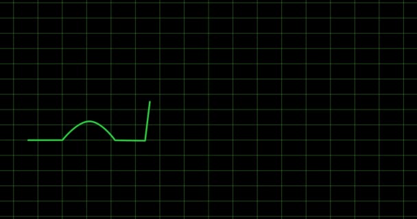 ligne verte faisant rythme sur fond noir 