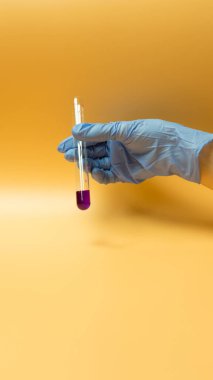 Mavi eldivenli bir el Coronavirus COVID-19 'un test tüpünü tutuyor. Sarı arkaplanda kavram