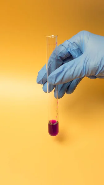 Mavi eldivenli bir el Coronavirus COVID-19 'un test tüpünü tutuyor. Sarı arkaplanda kavram